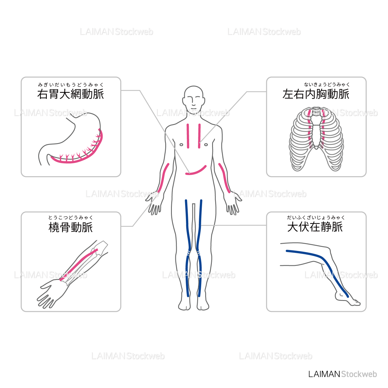 代表的なバイパスグラフト(文字入り)