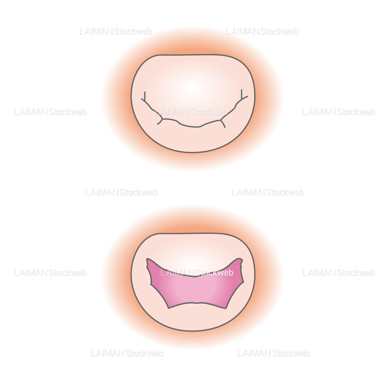 僧帽弁(上から見たところ)