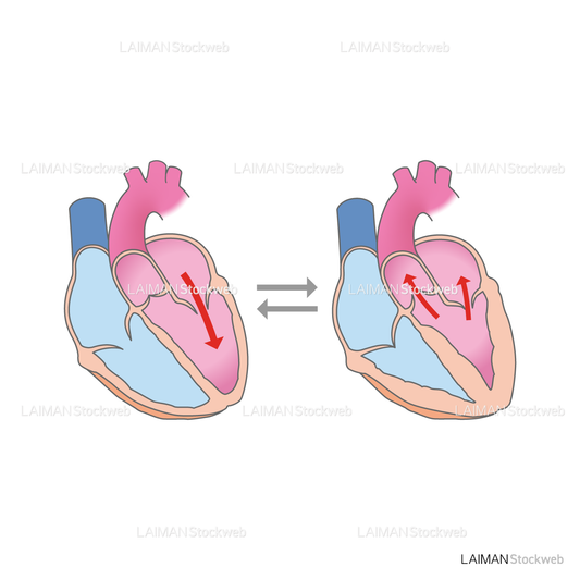 僧帽弁閉鎖不全症(僧帽弁閉鎖不全症説明用2)