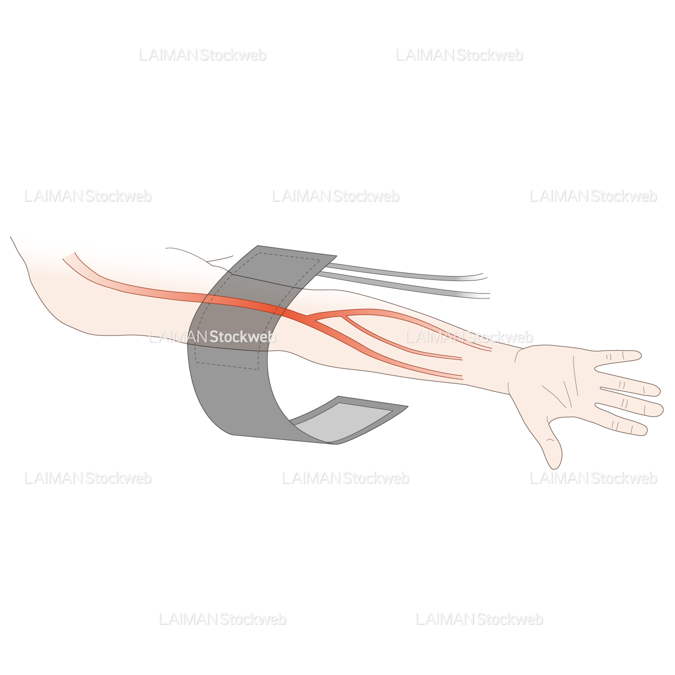 血圧の測定(マンシェットの位置)