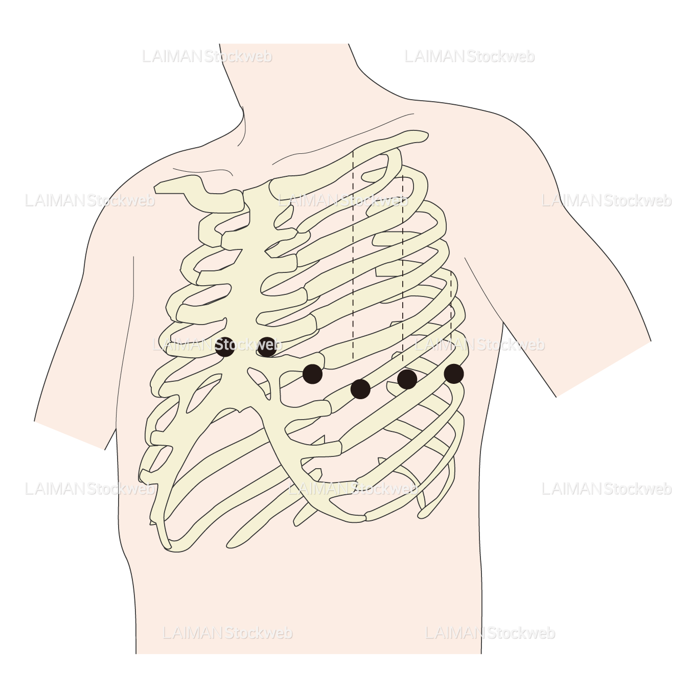 電極位置(単極胸部誘導)