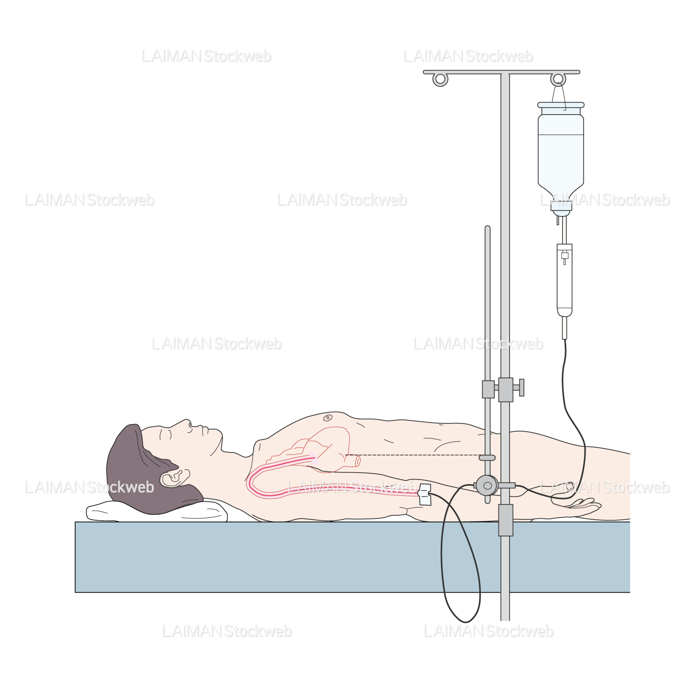中心静脈圧(CVP)測定法