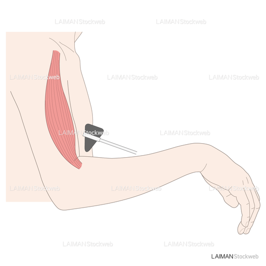 神経根障害高位診断(上腕二頭筋:反射)