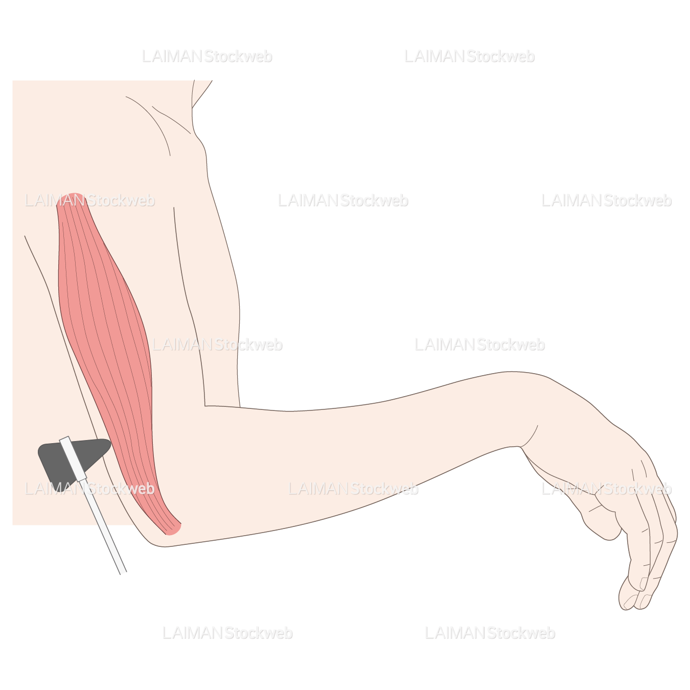 神経根障害高位診断(上腕三頭筋)
