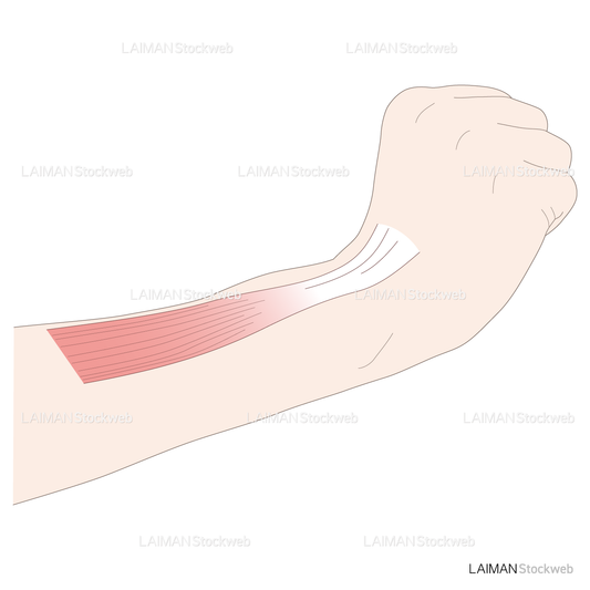 神経根障害高位診断(長橈側手根伸筋:伸展)