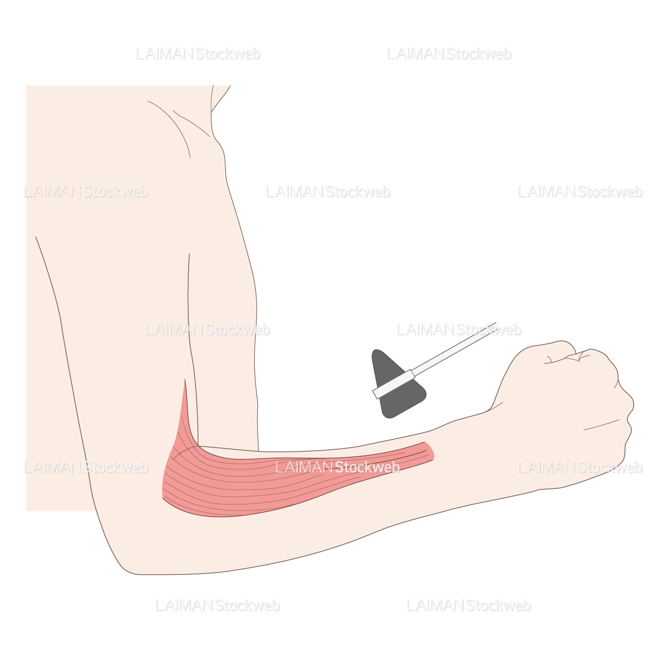 神経根障害高位診断(長橈側手根伸筋:外転)