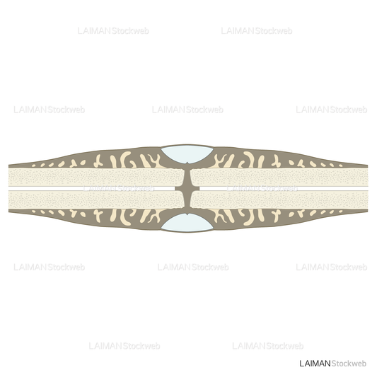 骨折治癒の段階(膜性骨化)