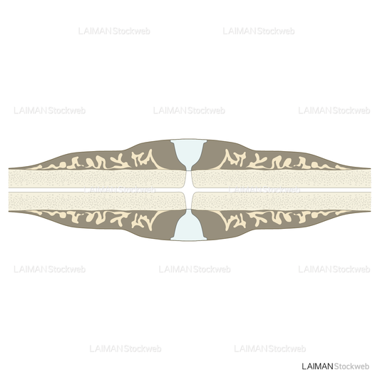 骨折治癒の段階(軟骨形成)