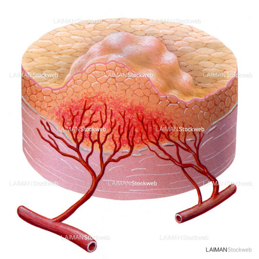血管形成4(/5)(がんと血液供給)