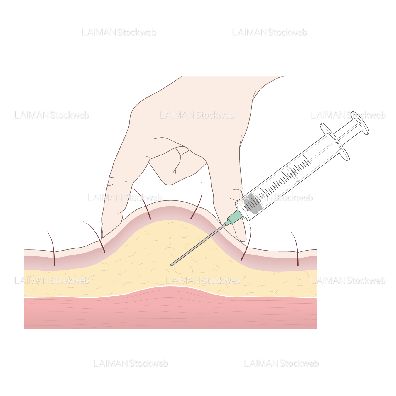 皮下注射（皮膚の厚いところ）