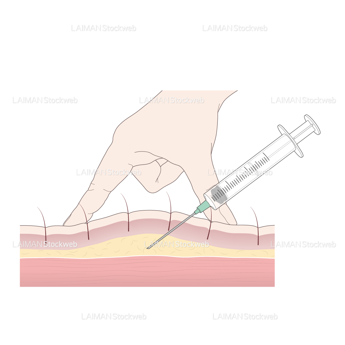 皮下注射（皮膚の薄いところ）