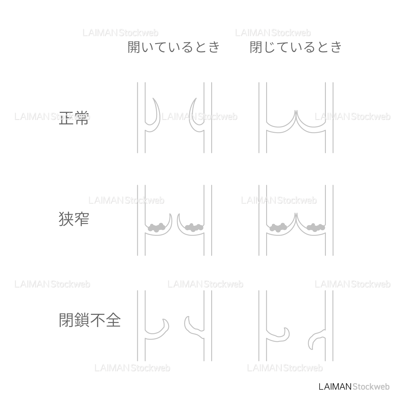 弁膜症_白地図