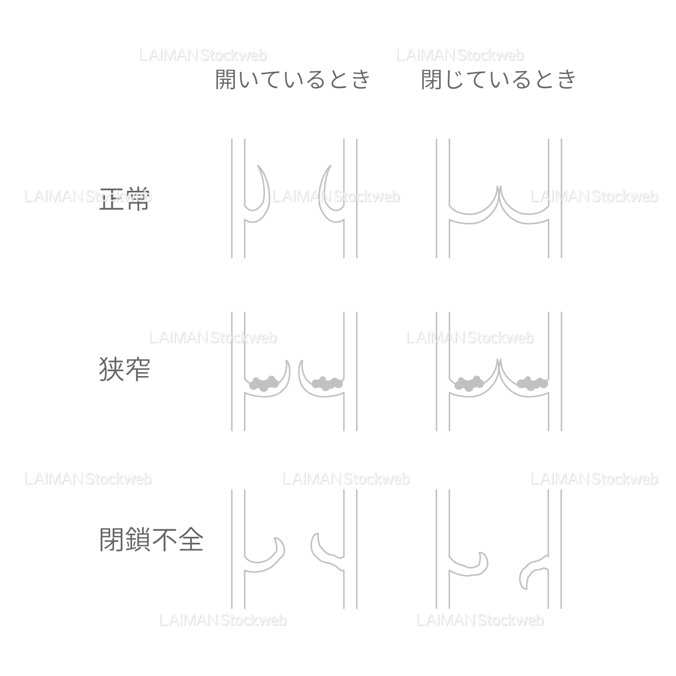 弁膜症_白地図