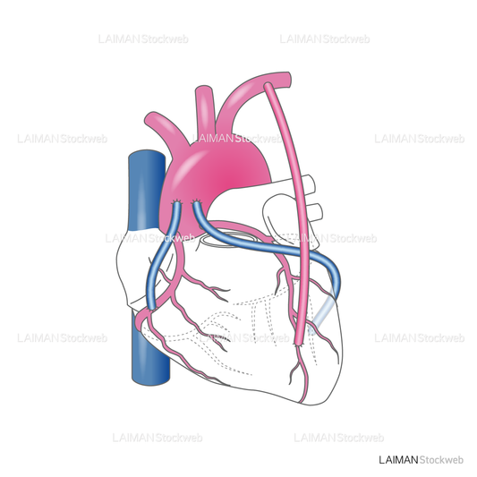 冠動脈バイパス術_心臓の図