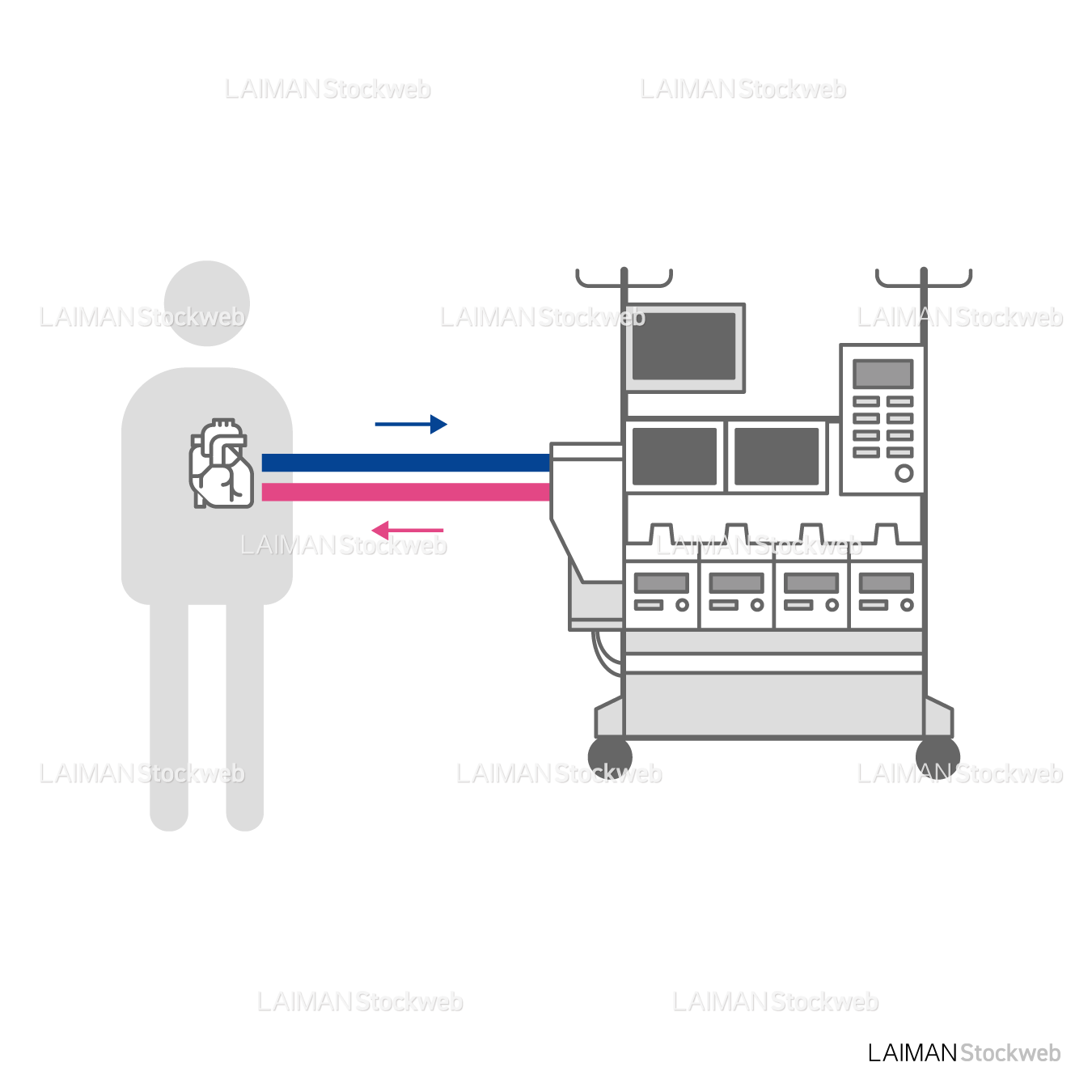 人工心肺装置-仕組み