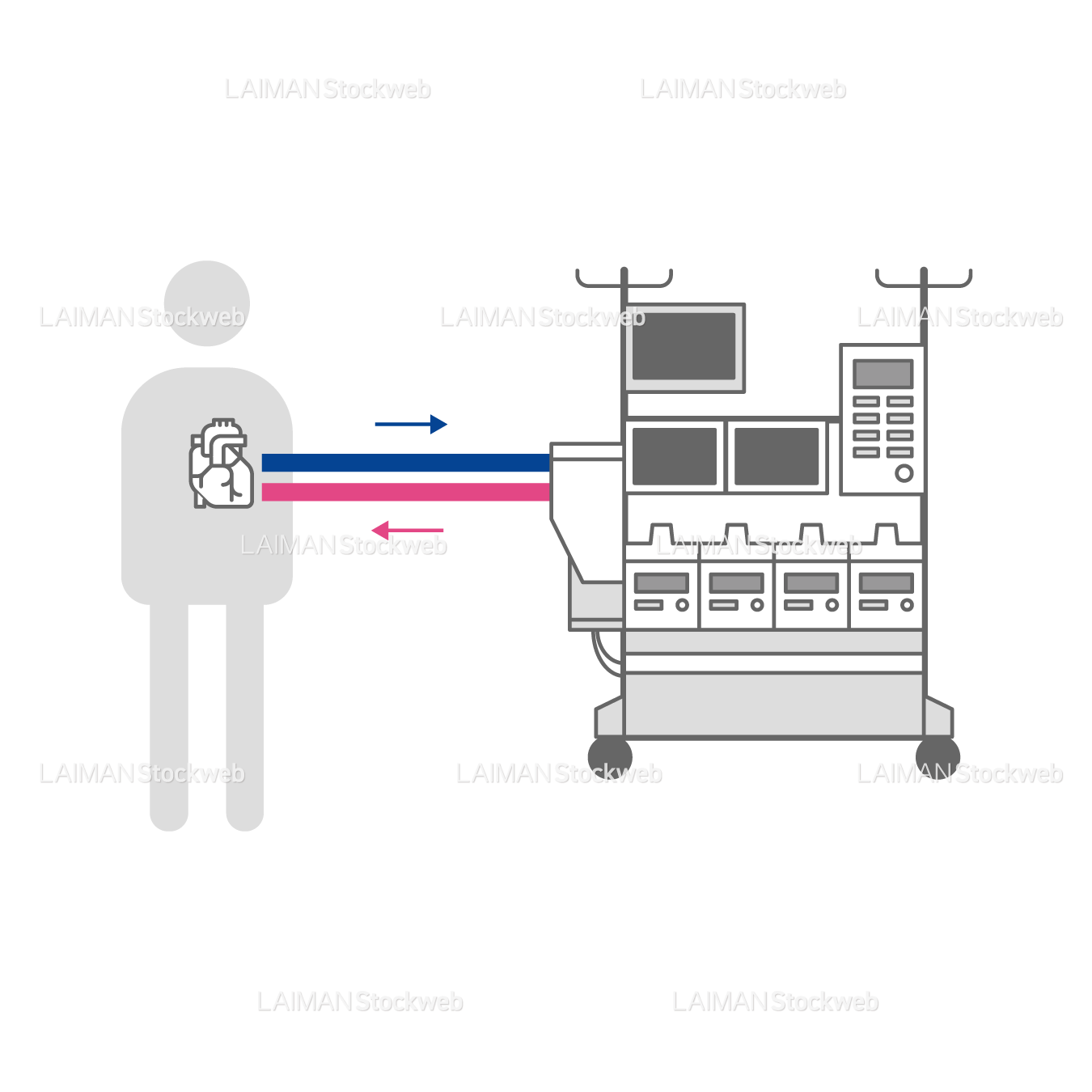 人工心肺装置-仕組み