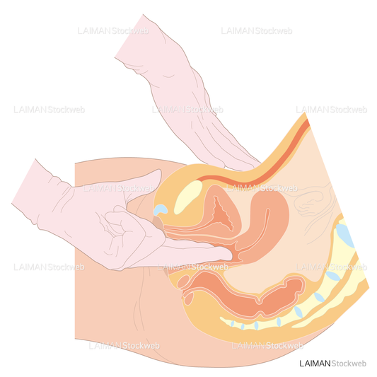婦人科内診／双合診