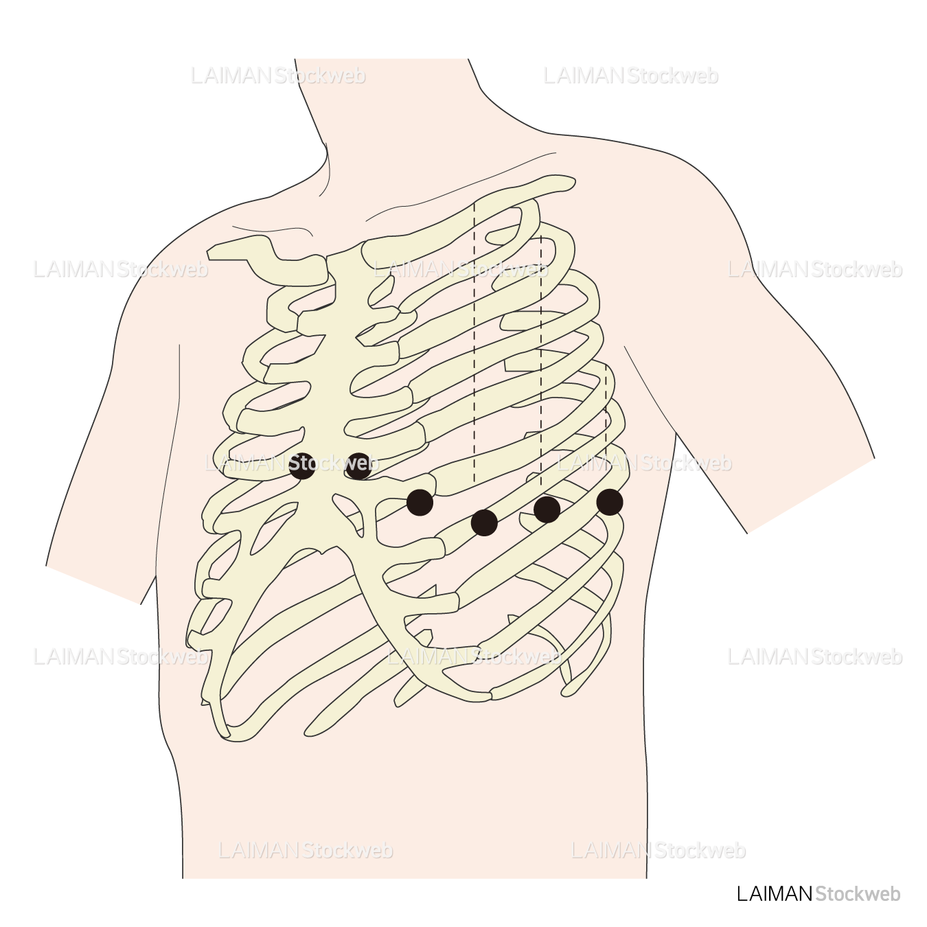 電極位置（単極胸部誘導）