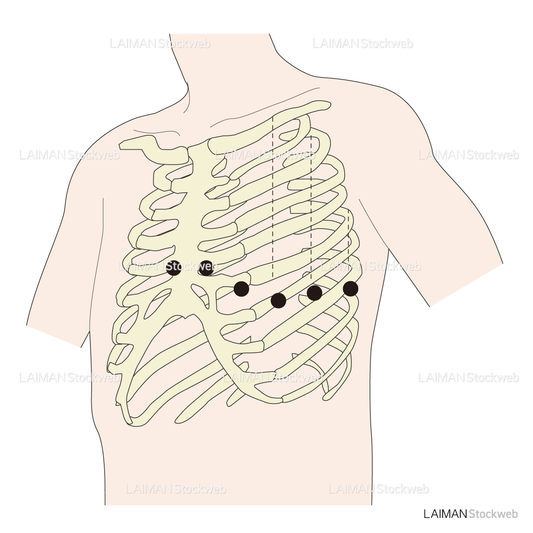 電極位置（単極胸部誘導）