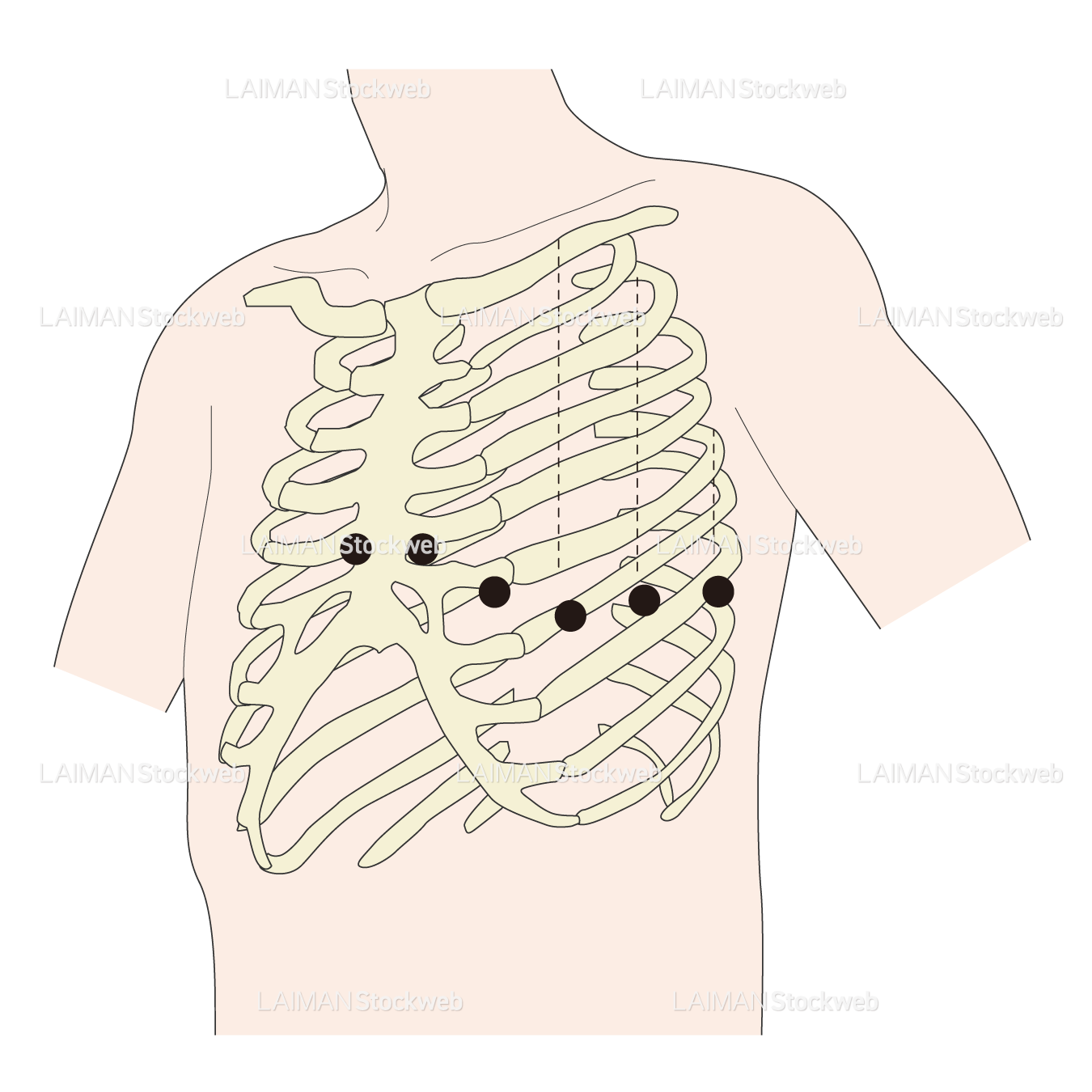 電極位置（単極胸部誘導）