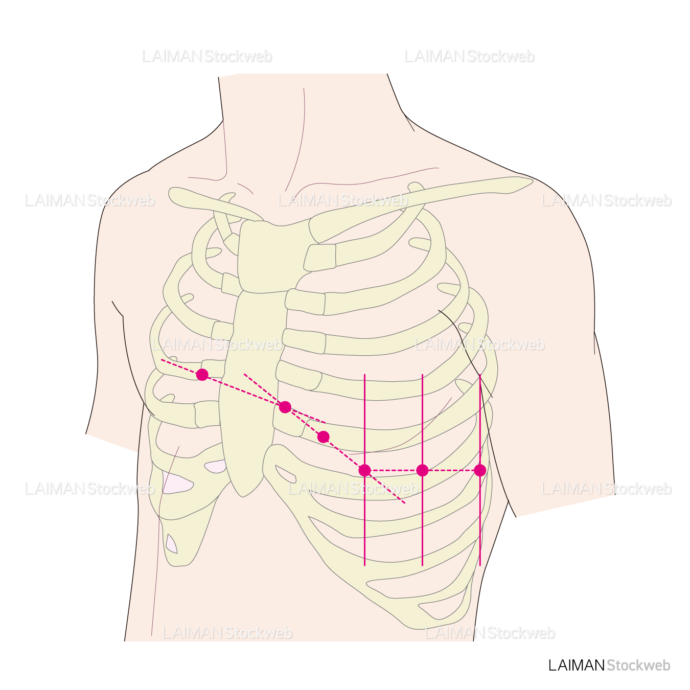 胸部誘導の吸盤の位置