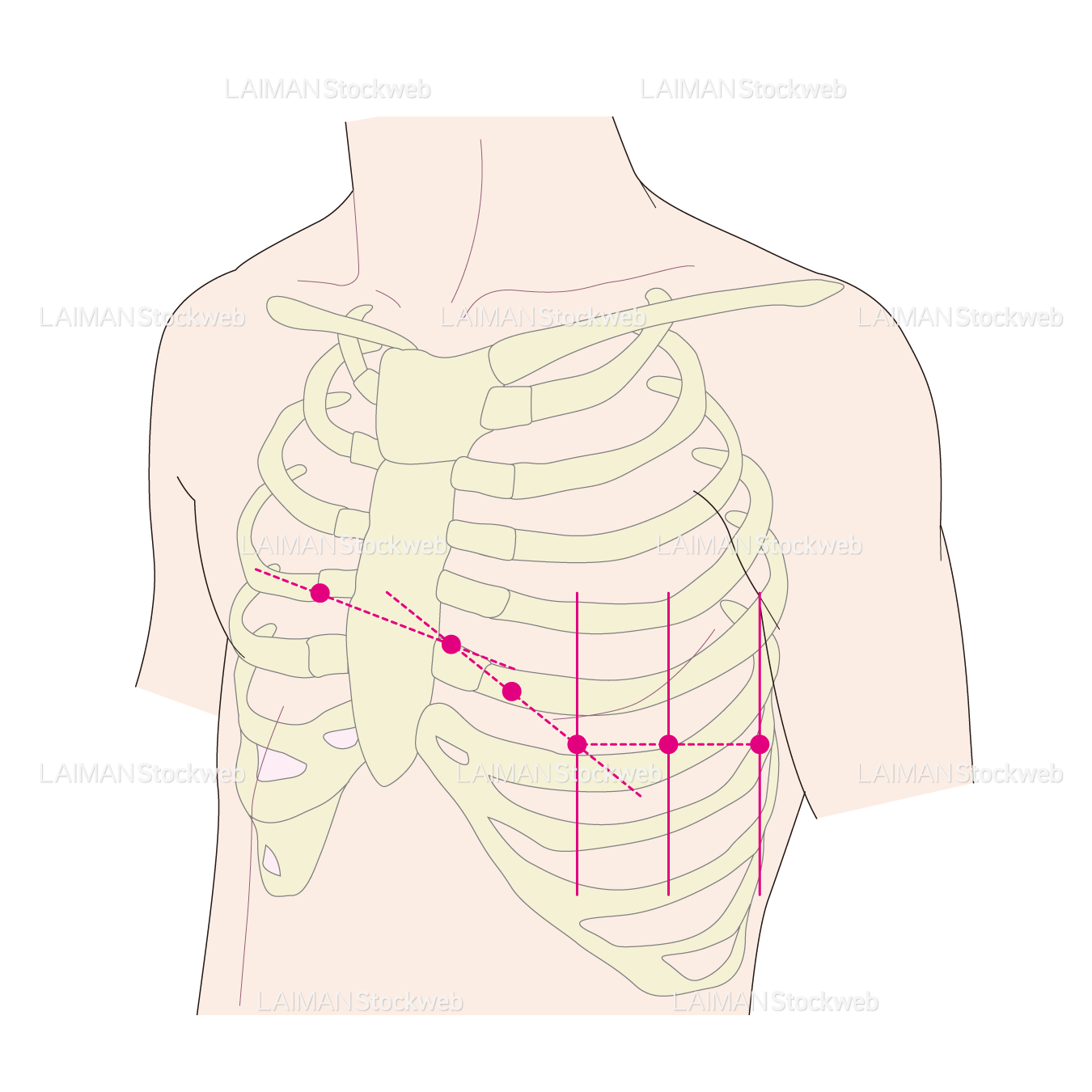 胸部誘導の吸盤の位置