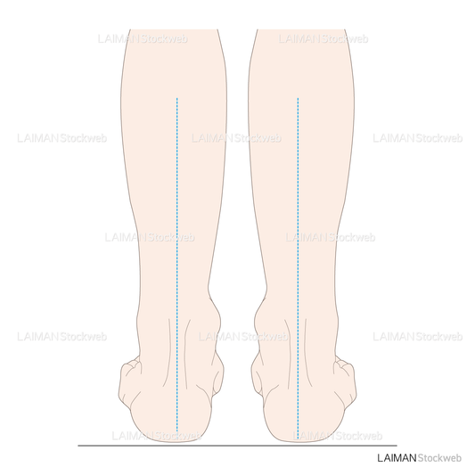 下腿のアライメント 正常