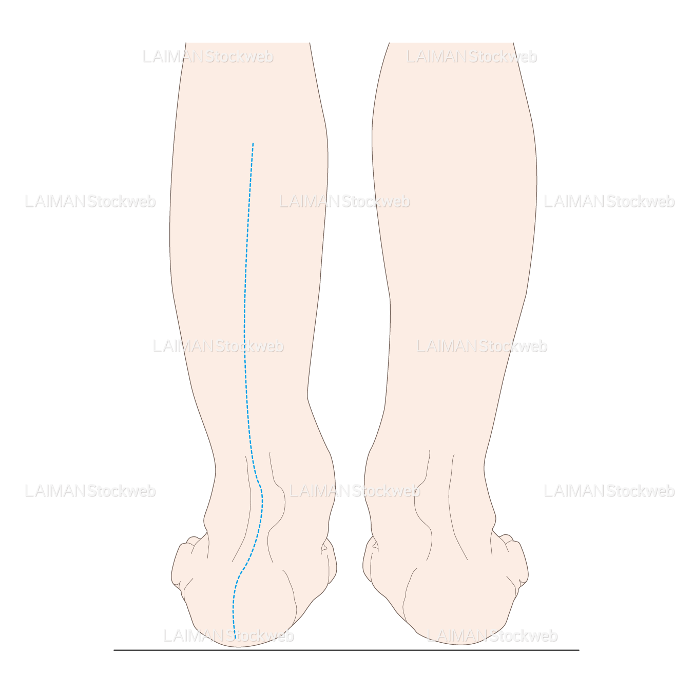下腿のアライメント 踵部外反